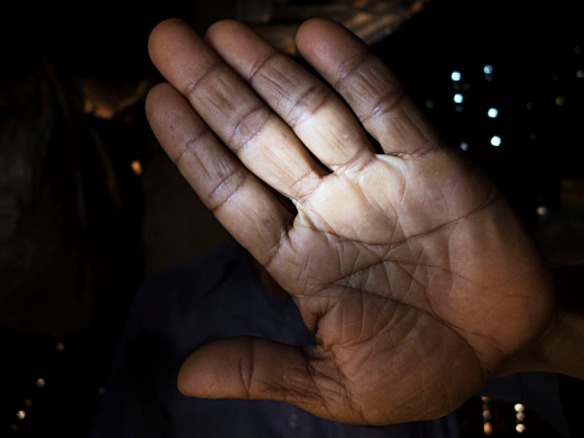 Hand of Kalpana’s brother Kalindi Kumar Chakma. He mentions how the torch light reflected from his hand lit up Lieutenant Ferdous’ face. Photo: Shahidul Alam/Drik/Majority World